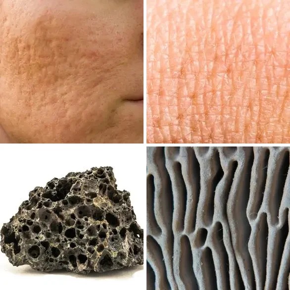 4 images 1 mot 5 lettres : solution PORES