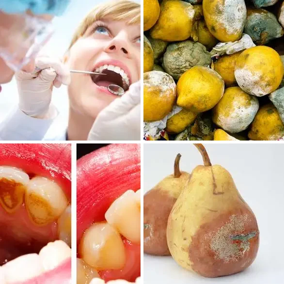 4 Images 1 Mot 6 lettres – POURRI – niveau 578 4 images 1 mot 6 lettres : solution POURRI