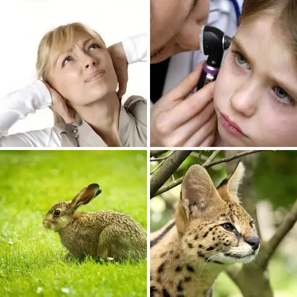 4 images 1 mot 7 lettres : solution OREILLE