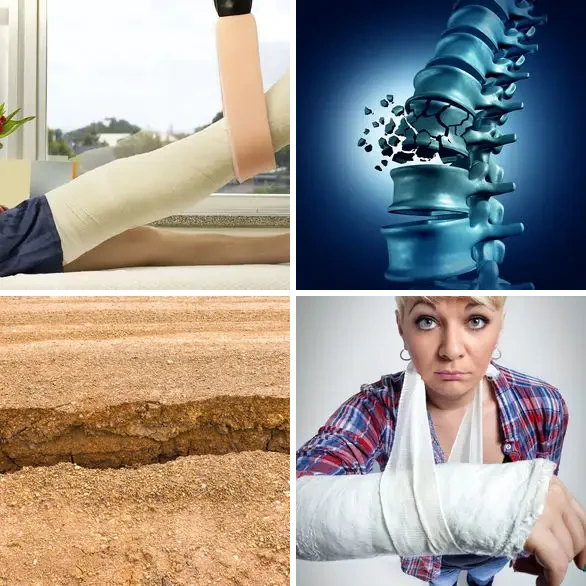 4 images 1 mot 8 lettres : solution FRACTURE